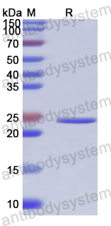 Recombinant Human FKBP7 Protein, N-His