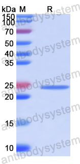 Recombinant Human POMT1 Protein, N-His