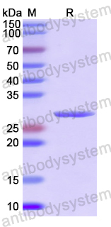 Recombinant Human CD265/TNFRSF11A Protein, N-His