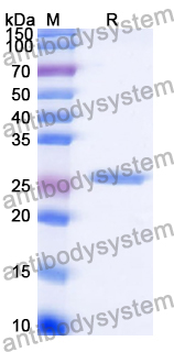 Recombinant Human IgE/IGHE Protein, N-His