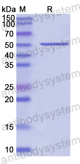 Recombinant Human IGHM Protein, N-His