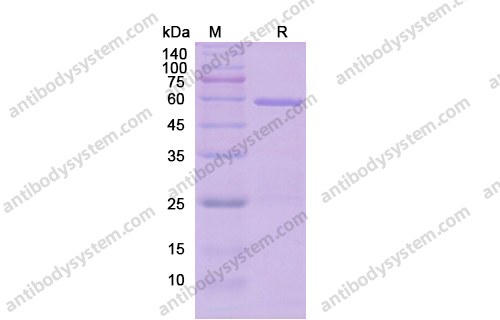 Recombinant Human IL35 Protein, N-His