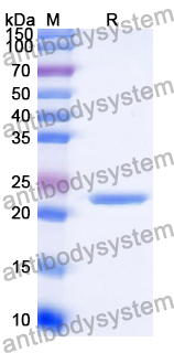 Recombinant Human CD368/CLEC4D Protein, N-His