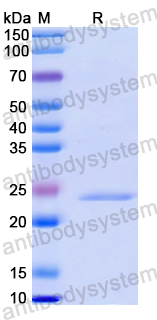 Recombinant Human CD370/CLEC9A Protein, C-His