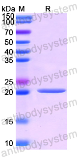 Recombinant Human PLA2G12A Protein, N-His