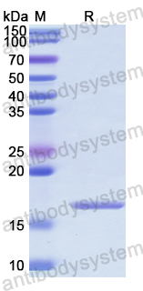 Recombinant Human NUSAP1 Protein, N-His