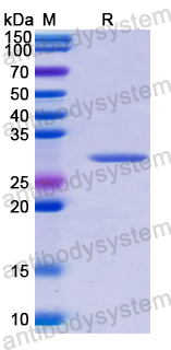 Recombinant Human ERP27 Protein, N-His