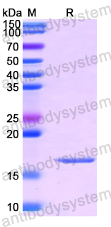 Recombinant Human ADIPOR1 Protein, N-His