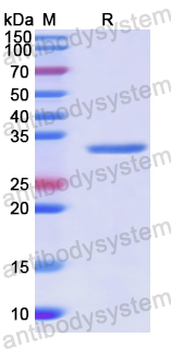 Recombinant Human AP2M1 Protein, N-His