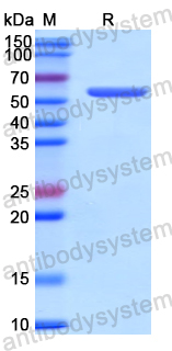 Recombinant Human RTCB Protein, N-His