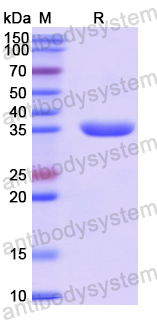 Recombinant Human ACSF2 Protein, N-His
