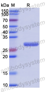Recombinant Human XPNPEP3 Protein, N-His