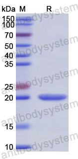 Recombinant Human CFL2 Protein, N-His