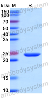 Recombinant Human CALN1 Protein, N-His