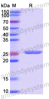 Recombinant Human AATF Protein, N-His