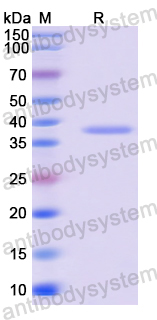 Recombinant Human AATF Protein, N-GST & C-His