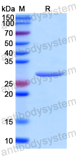 Recombinant Human ABCF2 Protein, N-His
