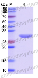 Recombinant Human ACSL5 Protein, N-His