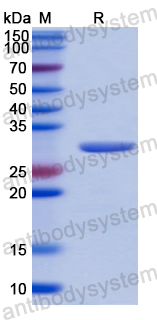 Recombinant Human EXO1 Protein, N-His