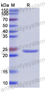 Recombinant Human DNAJC12 Protein, N-His