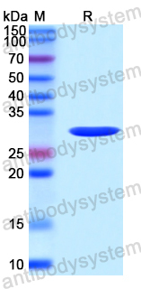 Recombinant Human C1QTNF1 Protein, N-His