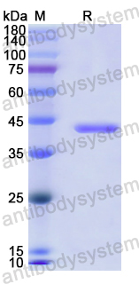 Recombinant Human PDGFD Protein, N-His