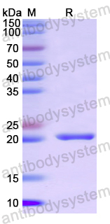 Recombinant Human CLMP Protein, N-His