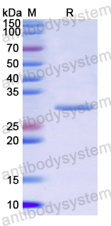 Recombinant Human AP1M1 Protein, N-His