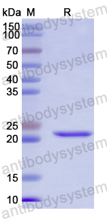 Recombinant Human FMO2 Protein, N-His