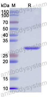 Recombinant Human SLC17A5 Protein, N-His