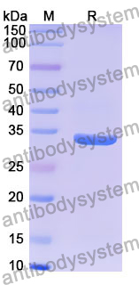 Recombinant Human SLC17A5 Protein, N-GST & C-His