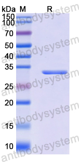 Recombinant Human AMACR Protein, N-His-SUMO