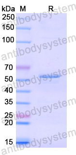 Recombinant Human CNDP2 Protein, N-His