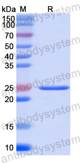 Recombinant Human ARL15 Protein, N-His