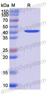 Recombinant Human BHMT2 Protein, N-His