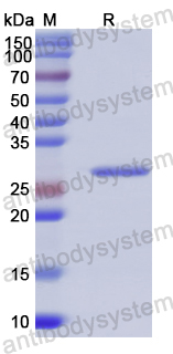 Recombinant Human ADD3 Protein, N-His