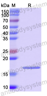 Recombinant Human GPIHBP1 Protein, N-His