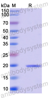Recombinant Human GPIHBP1 Protein, N-His-SUMO