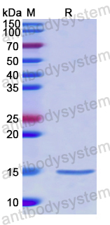 Recombinant Human B3GNT3 Protein, N-His