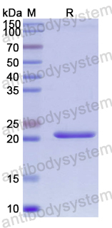 Recombinant Human CHKB Protein, N-His