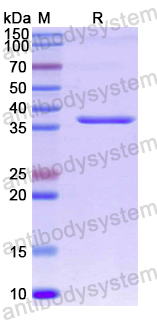 Recombinant Human TNS1 Protein, N-His