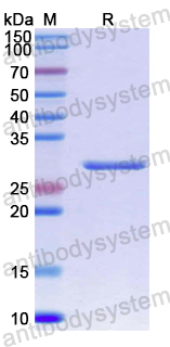 Recombinant Human TNS3 Protein, N-His