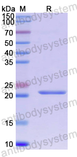 Recombinant Human ACD Protein, N-His