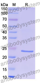 Recombinant Human ACD Protein, N-His-SUMO