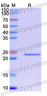 Recombinant Human AMFR Protein, N-His