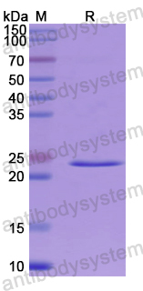 Recombinant Human BCOR Protein, N-His