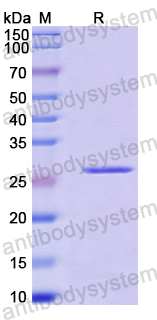 Recombinant Human BCOR Protein, N-His-SUMO