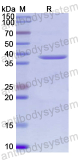 Recombinant Human DNM3 Protein, N-His