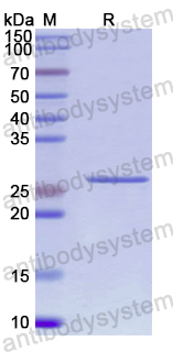 Recombinant Human KLK4 Protein, N-His