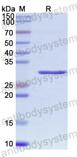 Recombinant Human TWNK Protein, N-His